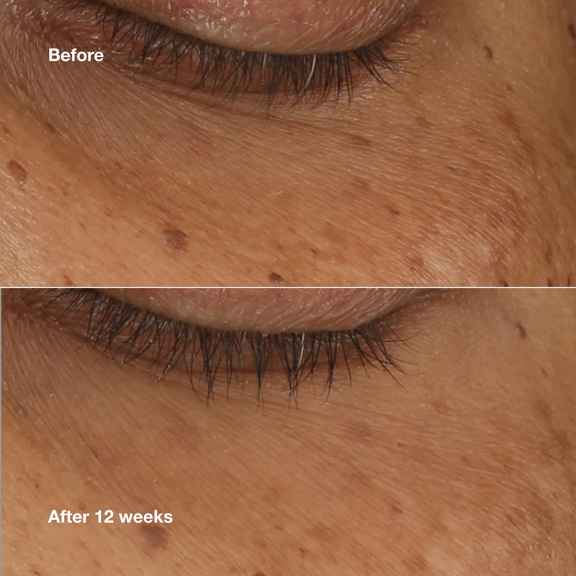 All About Eyes™ Brightening Serum Concentrate - Image 3