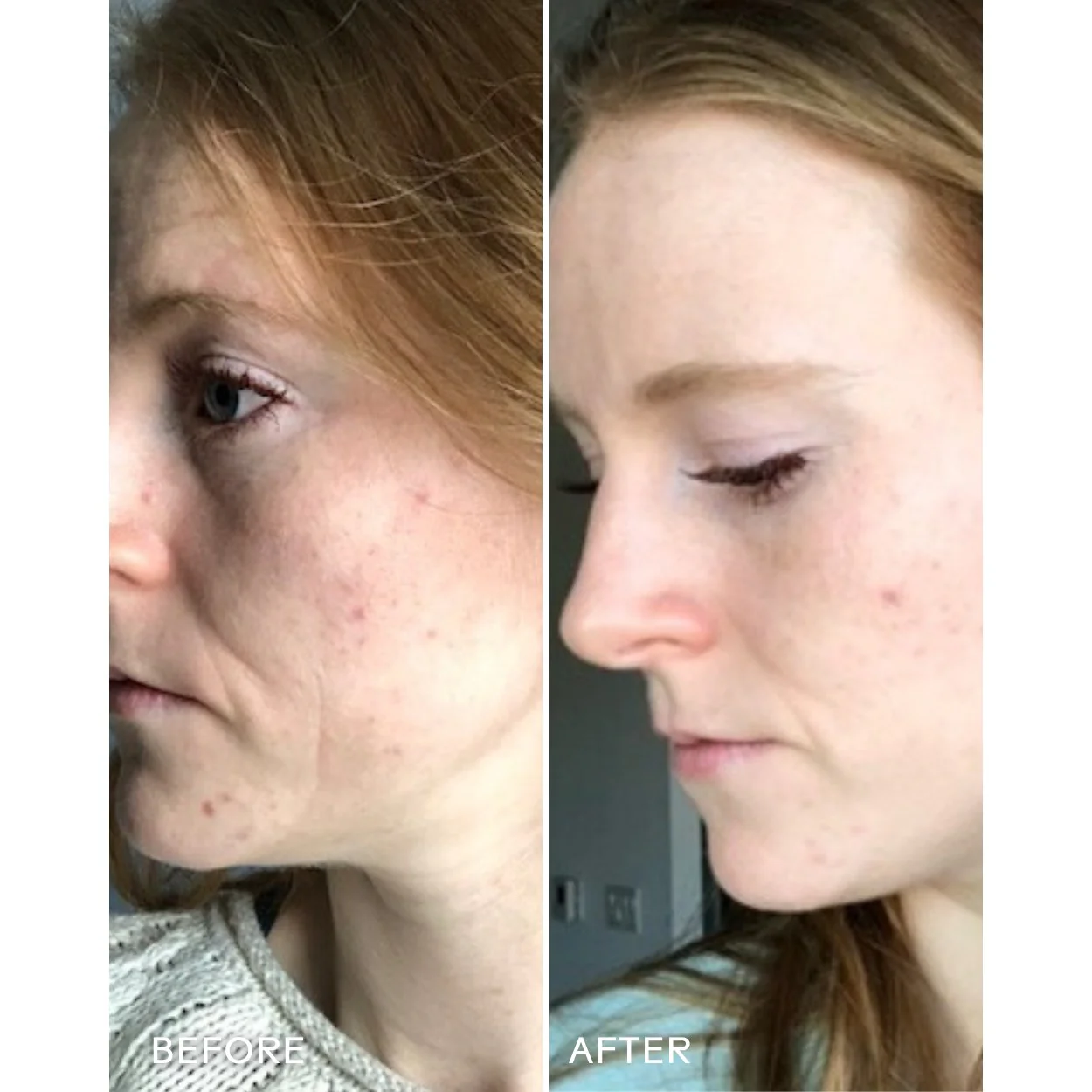 REFRESH PAPAYA + SALICYLIC ACID FOAMING CLEANSER - Image 3