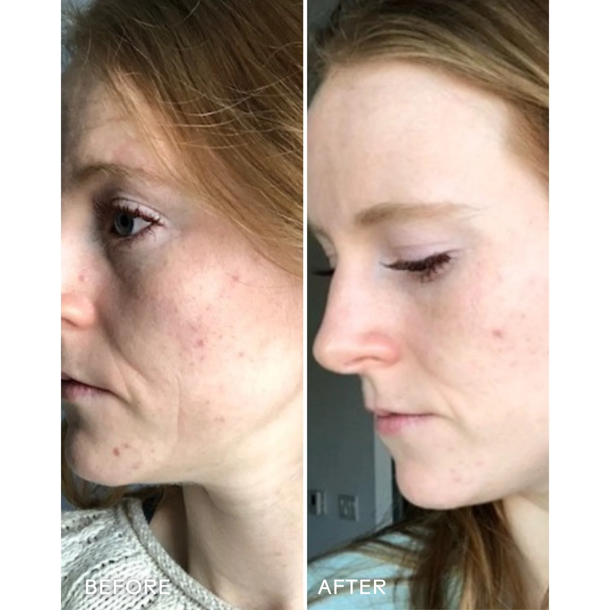 REFRESH PAPAYA + SALICYLIC ACID FOAMING CLEANSER - Image 8